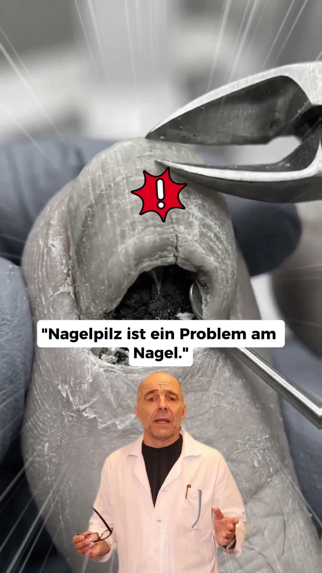 Nagelpilz Ratgeber Facebook ad: Der größte Fehler bei Nagelpilz
