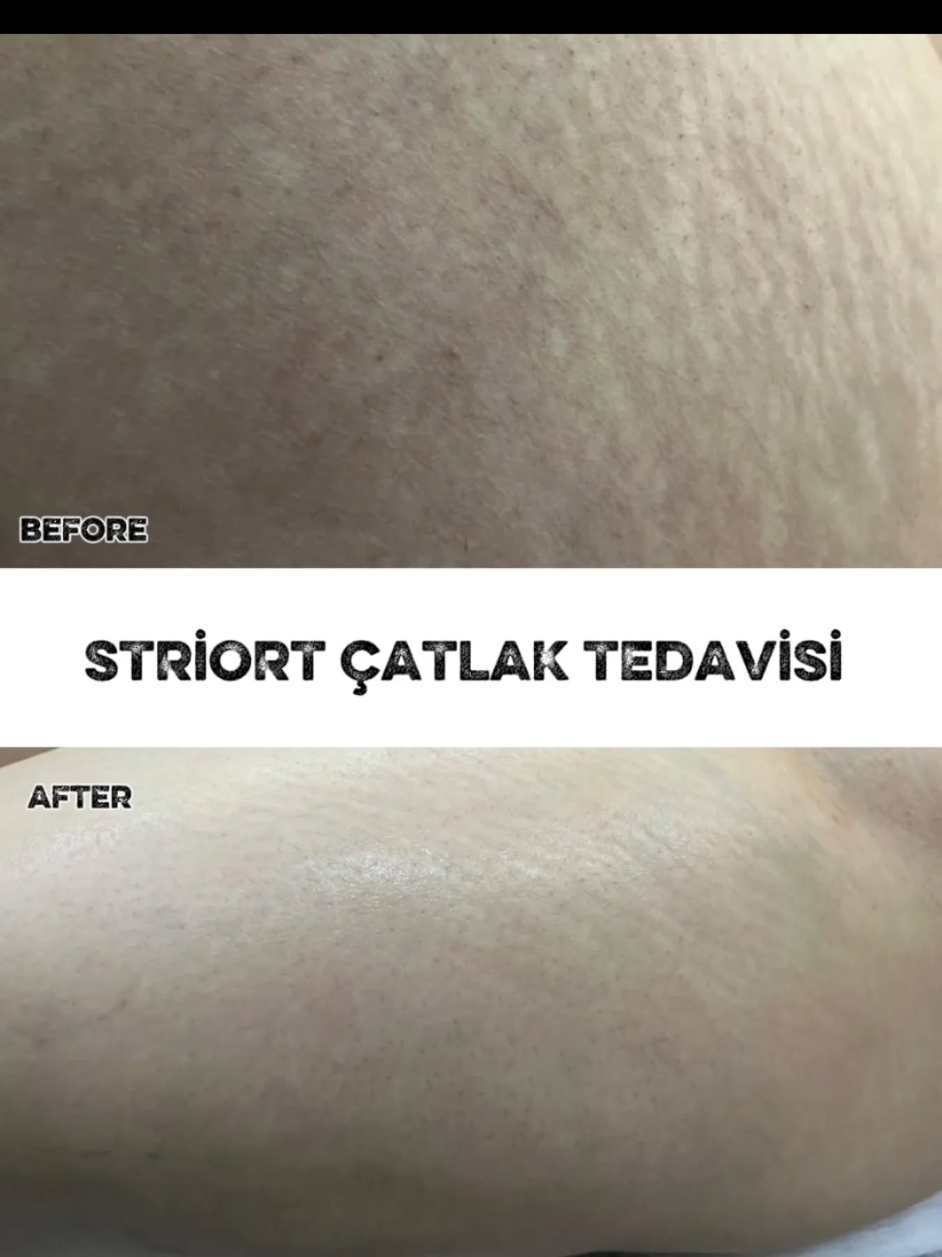 𝘼𝙧𝙞𝙨 𝙈𝙖𝙡𝙖𝙩𝙮𝙖 𝙑𝙞𝙥 Facebook ad: ÇATLAKLARA VEDA VAKTİ