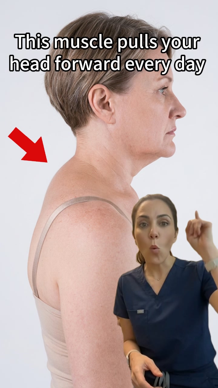 HiZoo Facebook ad: I fixed my neck hump without a chiropractor or a single…