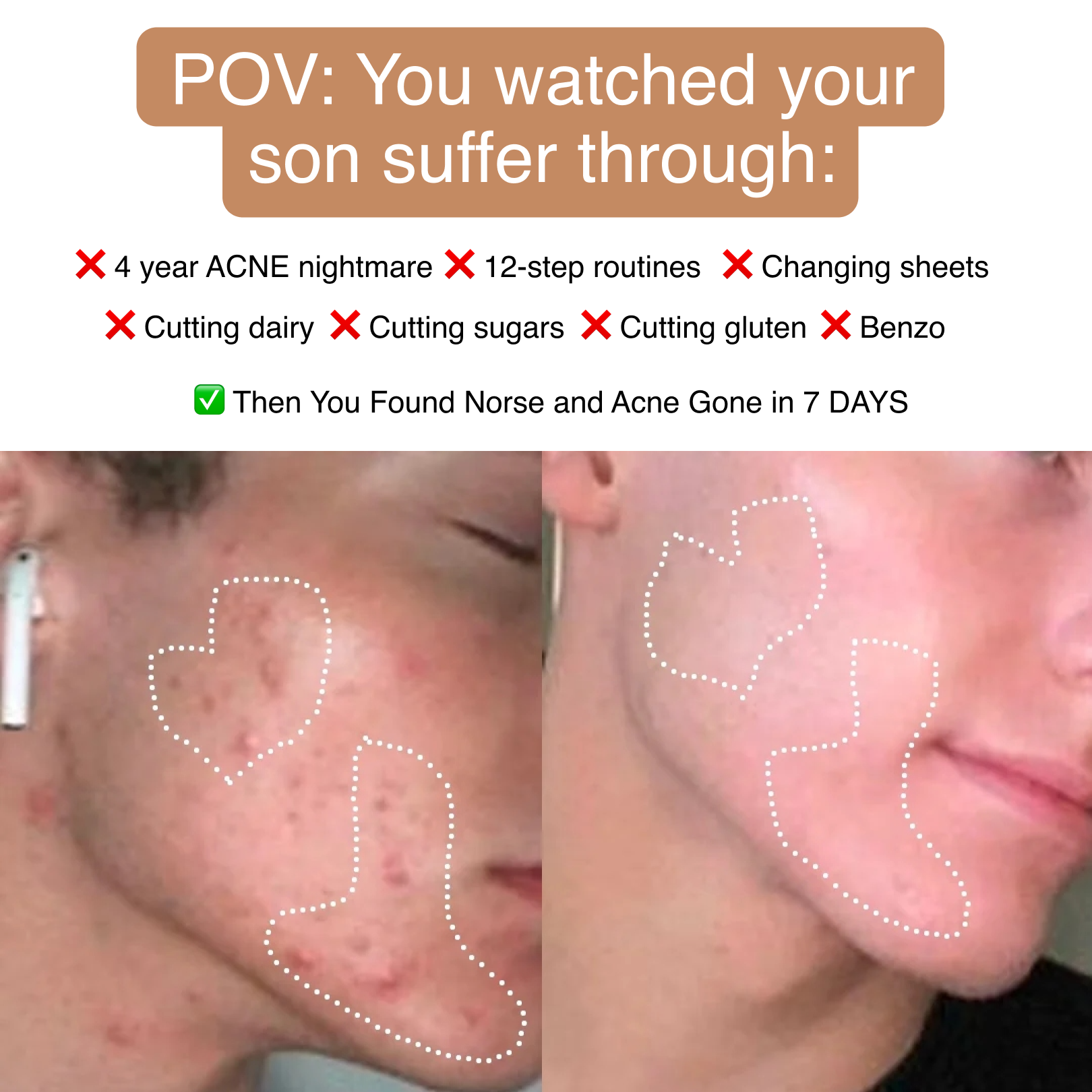 Anne's Skincare Blog Facebook ad