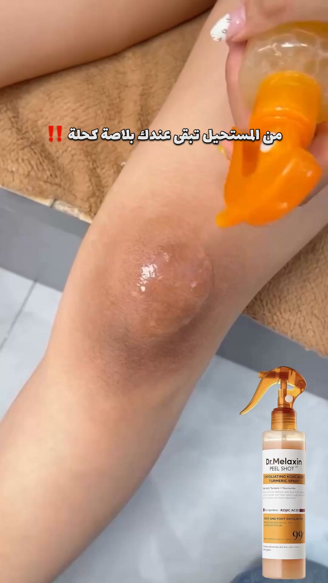Skin shopping Facebook ad: تهناي من كحولية الجسم وتصبغات الشمس!