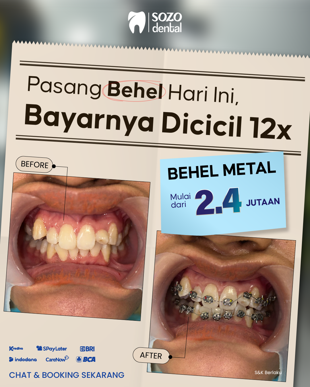 Sozo Dental Clinic Facebook ad