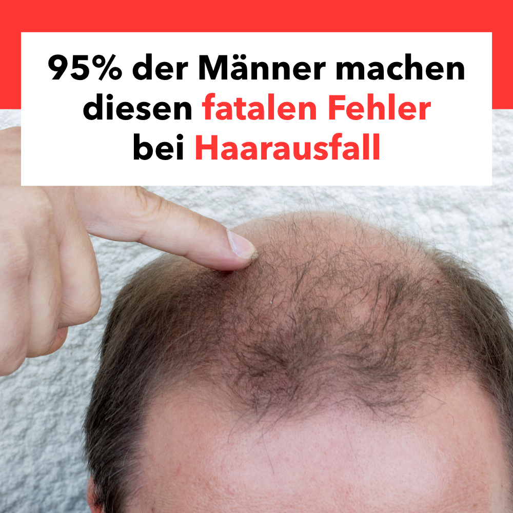 Haarausfallhilfe Facebook ad