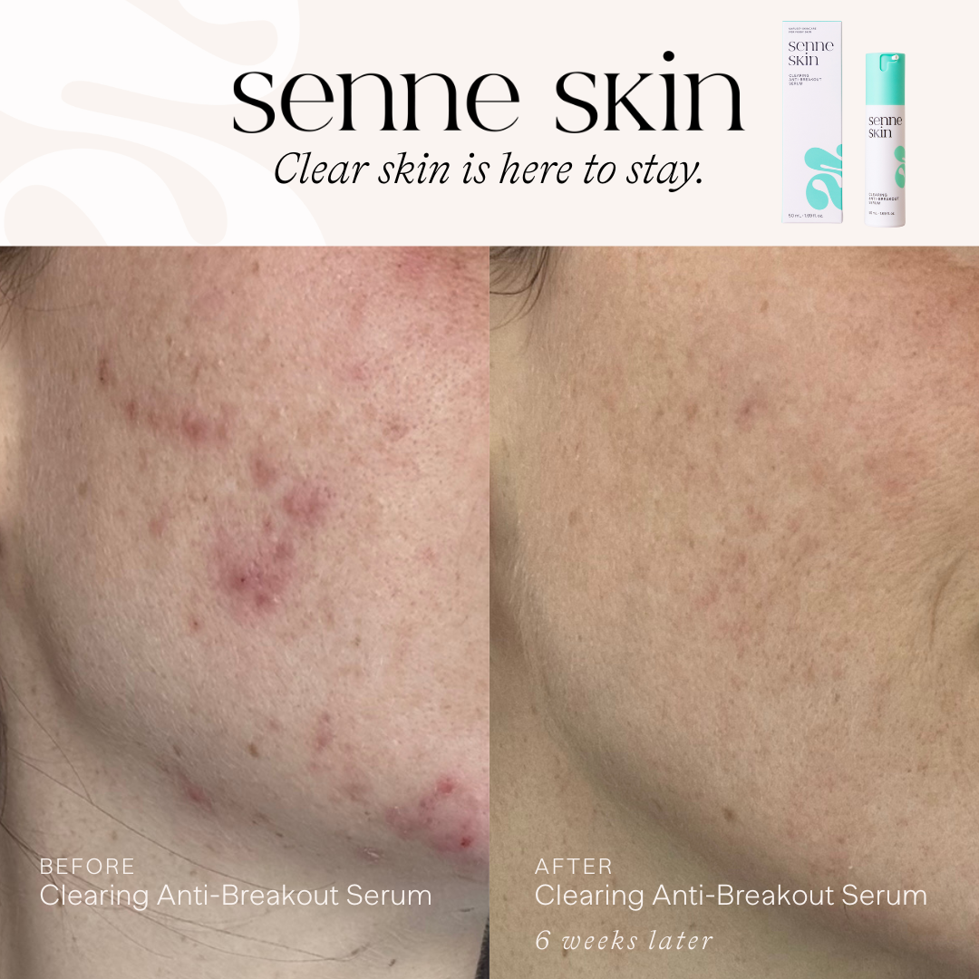 Senne Skin Facebook ad from Feb 2, 2026
