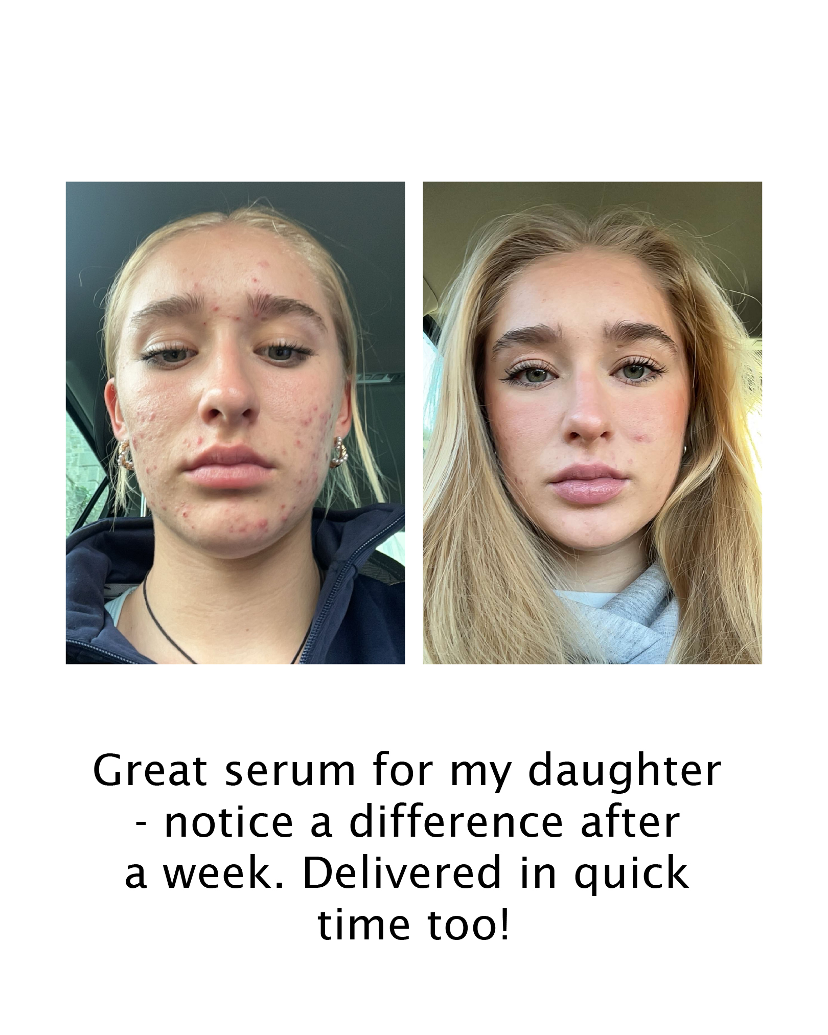 Honest Mum Reviews Facebook ad