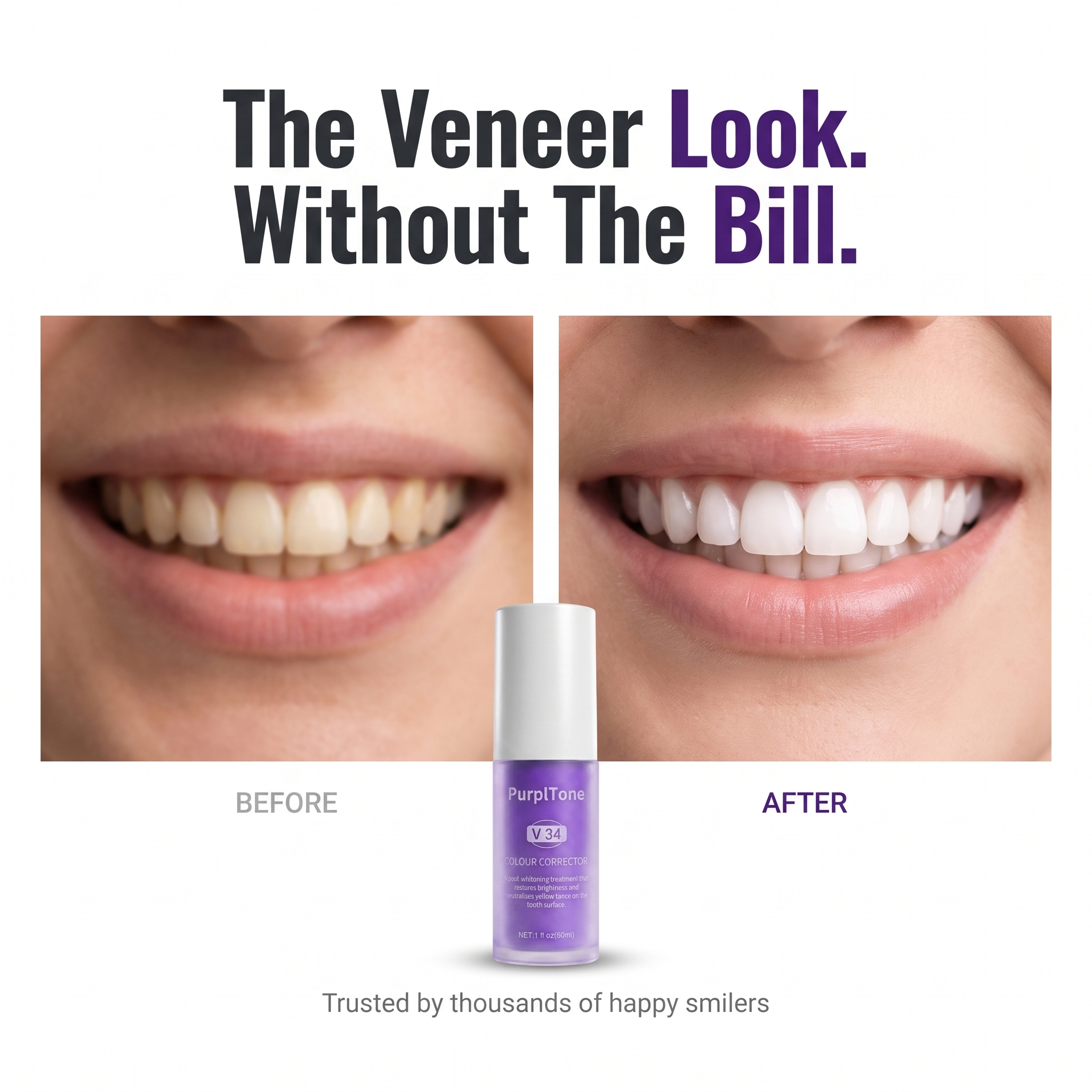 PurplTone Facebook ad: The smile people assume cost thousands.