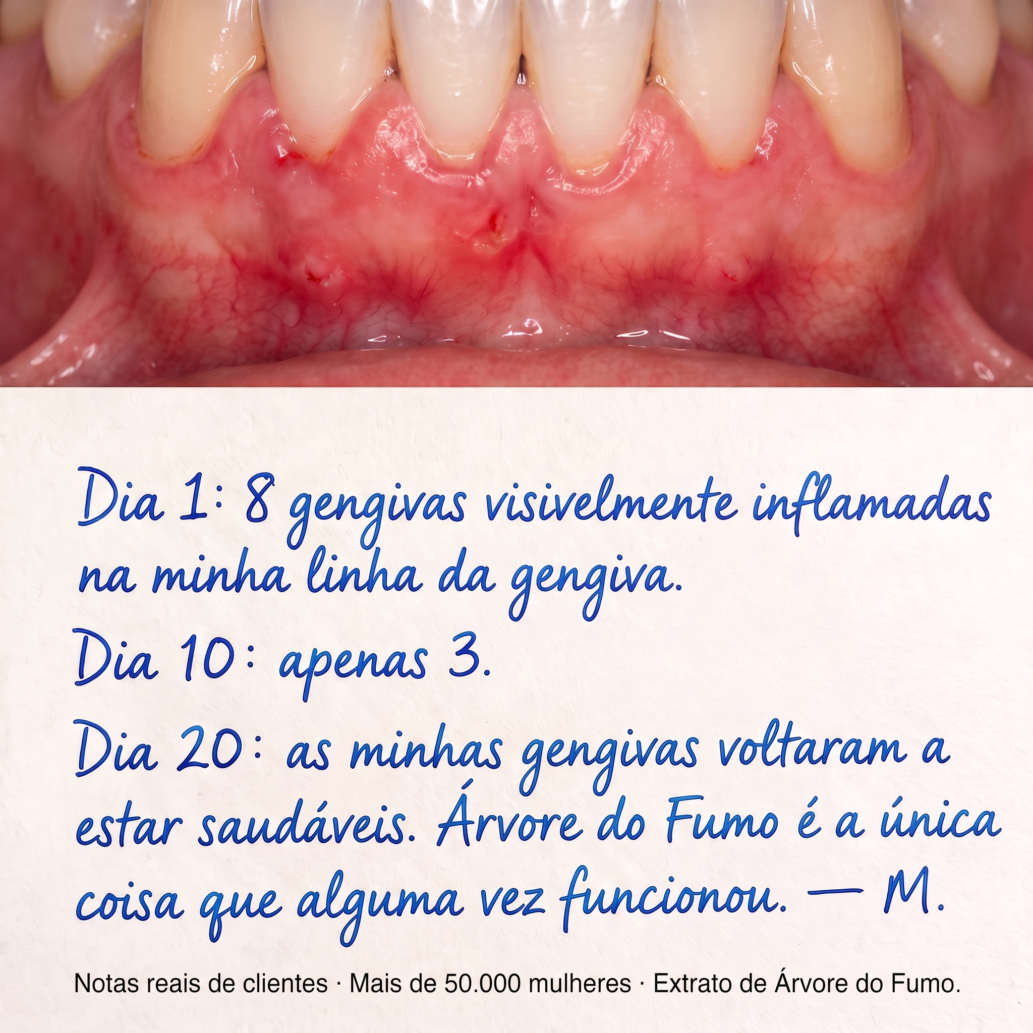 Cosméticos Orgânicos Familiares - InaEssentials.PT Facebook ad: Dia 1: 8 gengivas inflamadas. Dia 20: saudáveis.