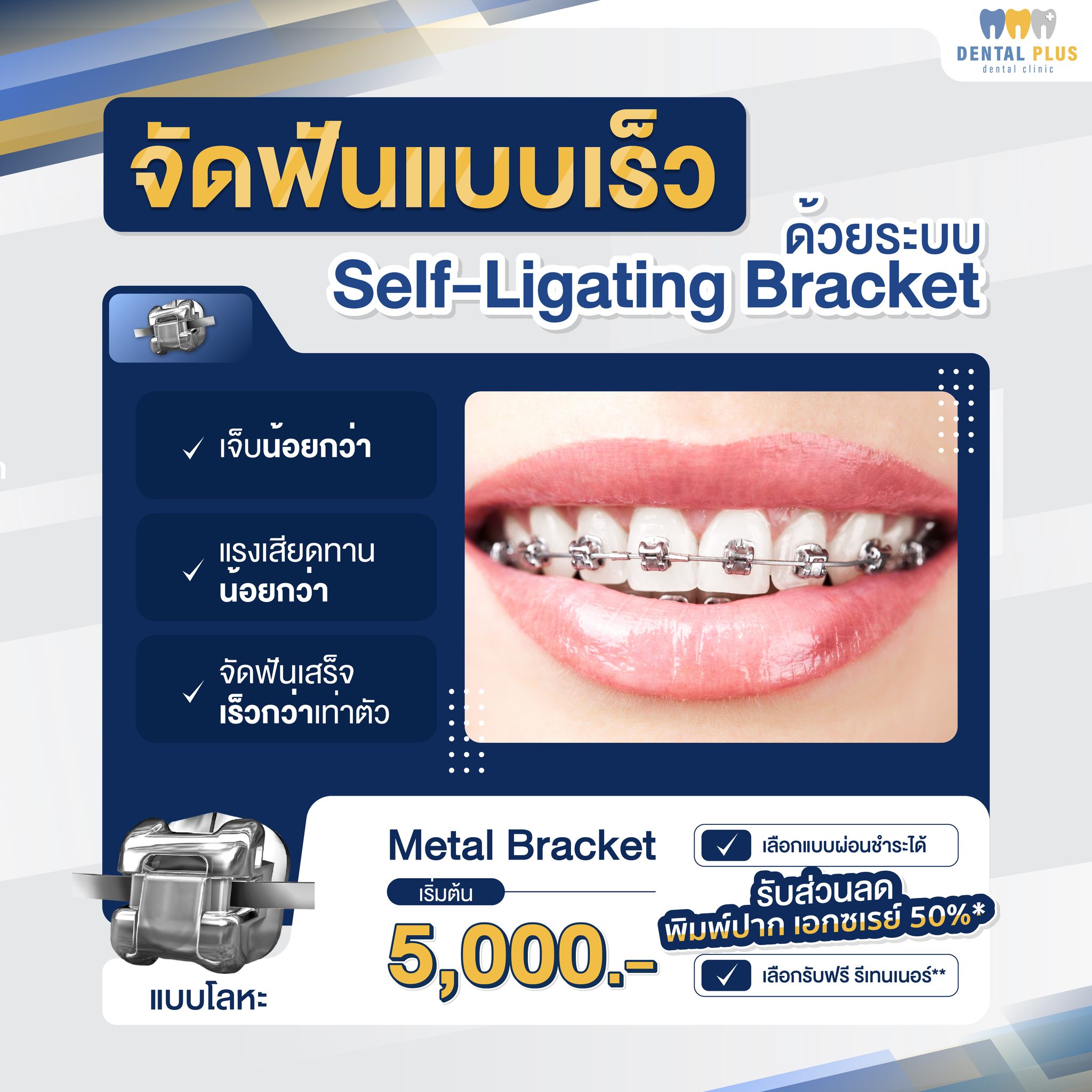 Dental Plus & The Dental Plus Facebook ad: จัดฟันแบบเร็ว ด้วยระบบ Self-ligating Bracket…