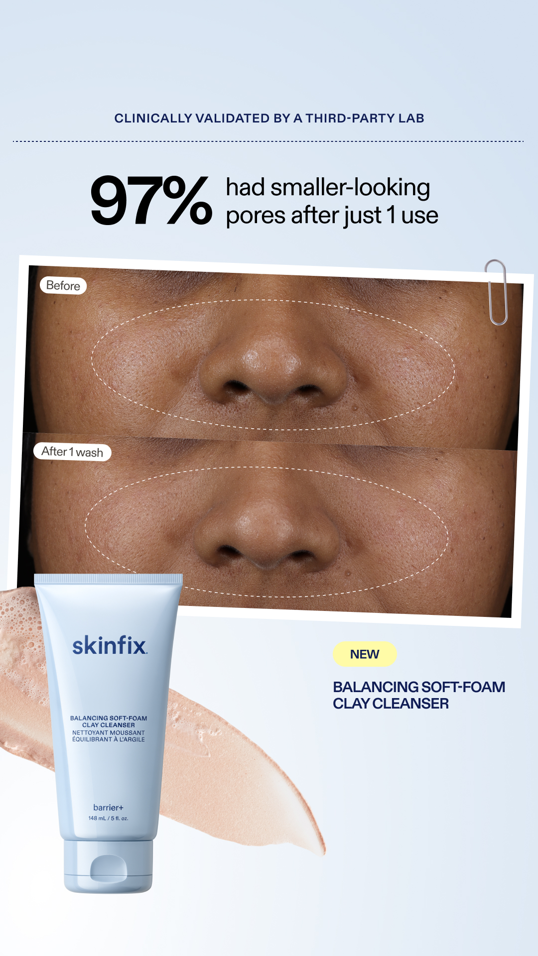 Skinfix Inc. Facebook ad