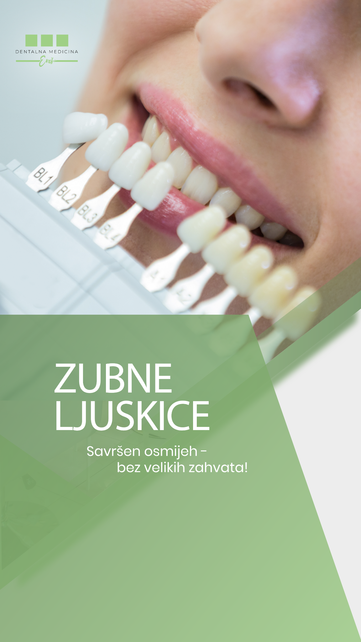 Dentalna medicina Ereš Facebook ad from Dec 2, 2025