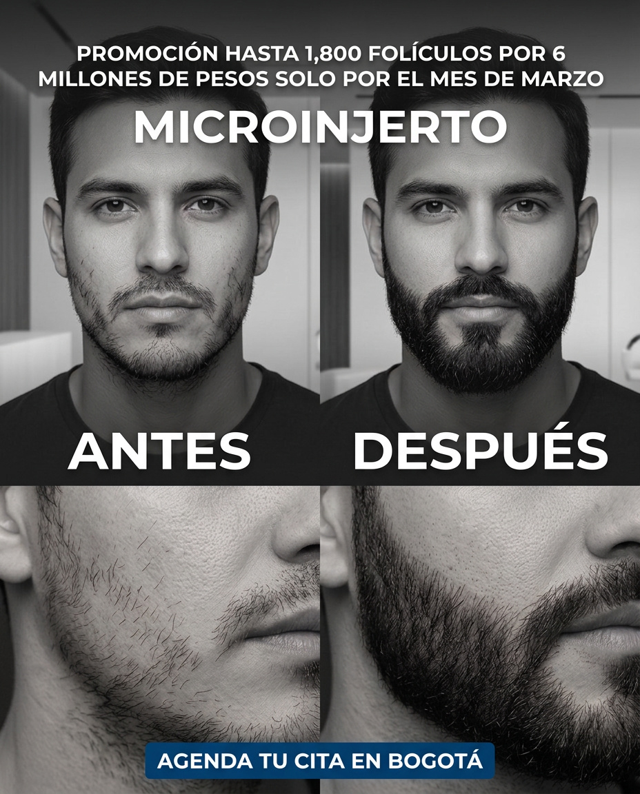 Pilosus Trasplante Capilar Facebook ad: Promo Barba este mes