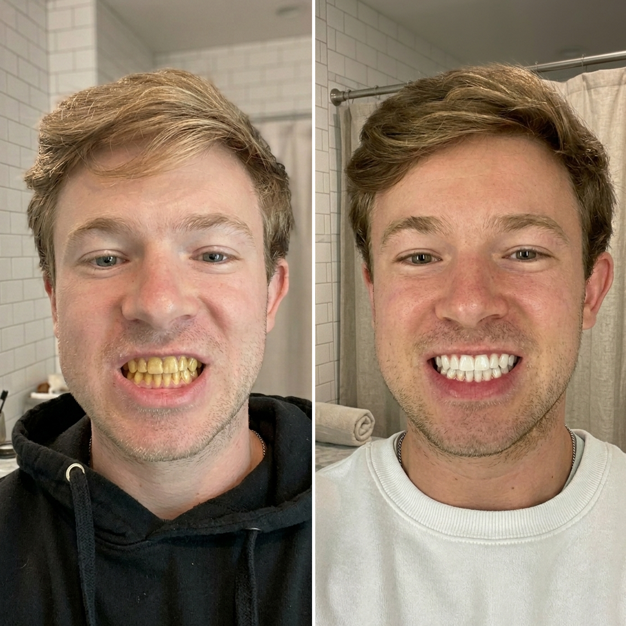 EBS Insider Facebook ad: The 2-Minute Whitening Trick That Works