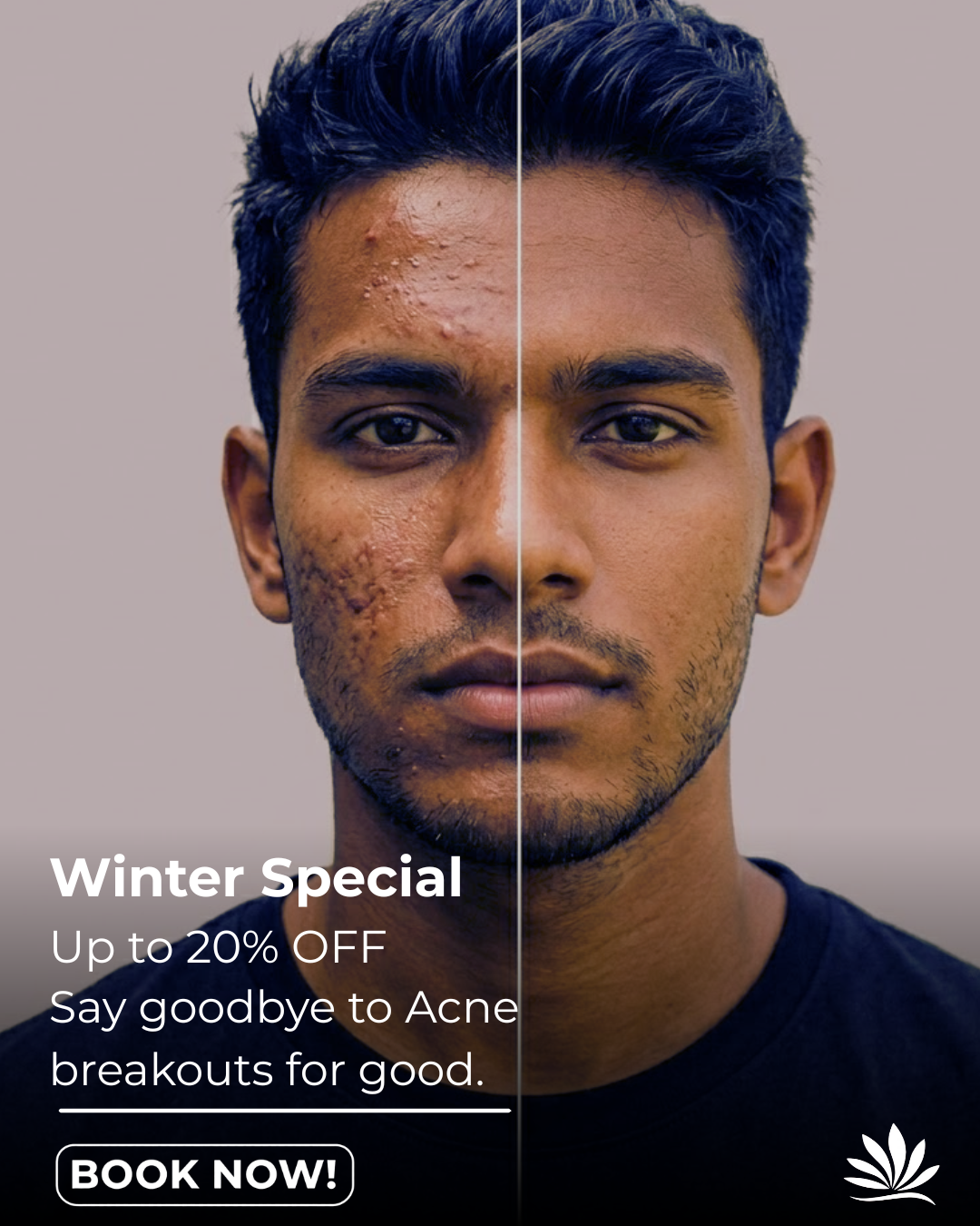 Prana Skin & Laser Clinic Facebook ad: Chat in Messenger