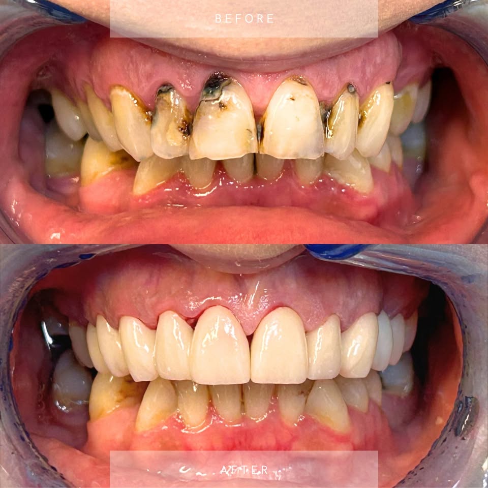 Boronia Heights Family Dental Facebook ad: Home - Boronia Heights Family Dental