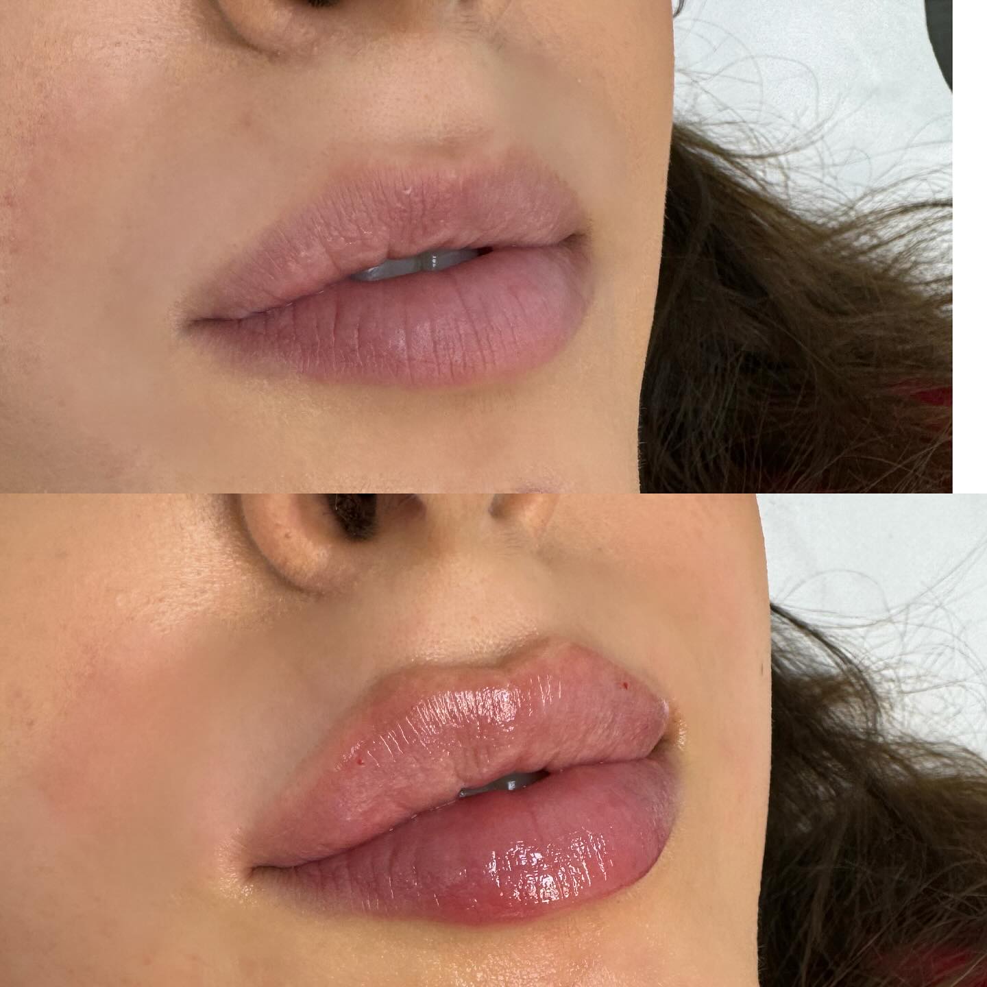 BeautyBar Facebook ad: Lip enhancement ⁣⁣1ml