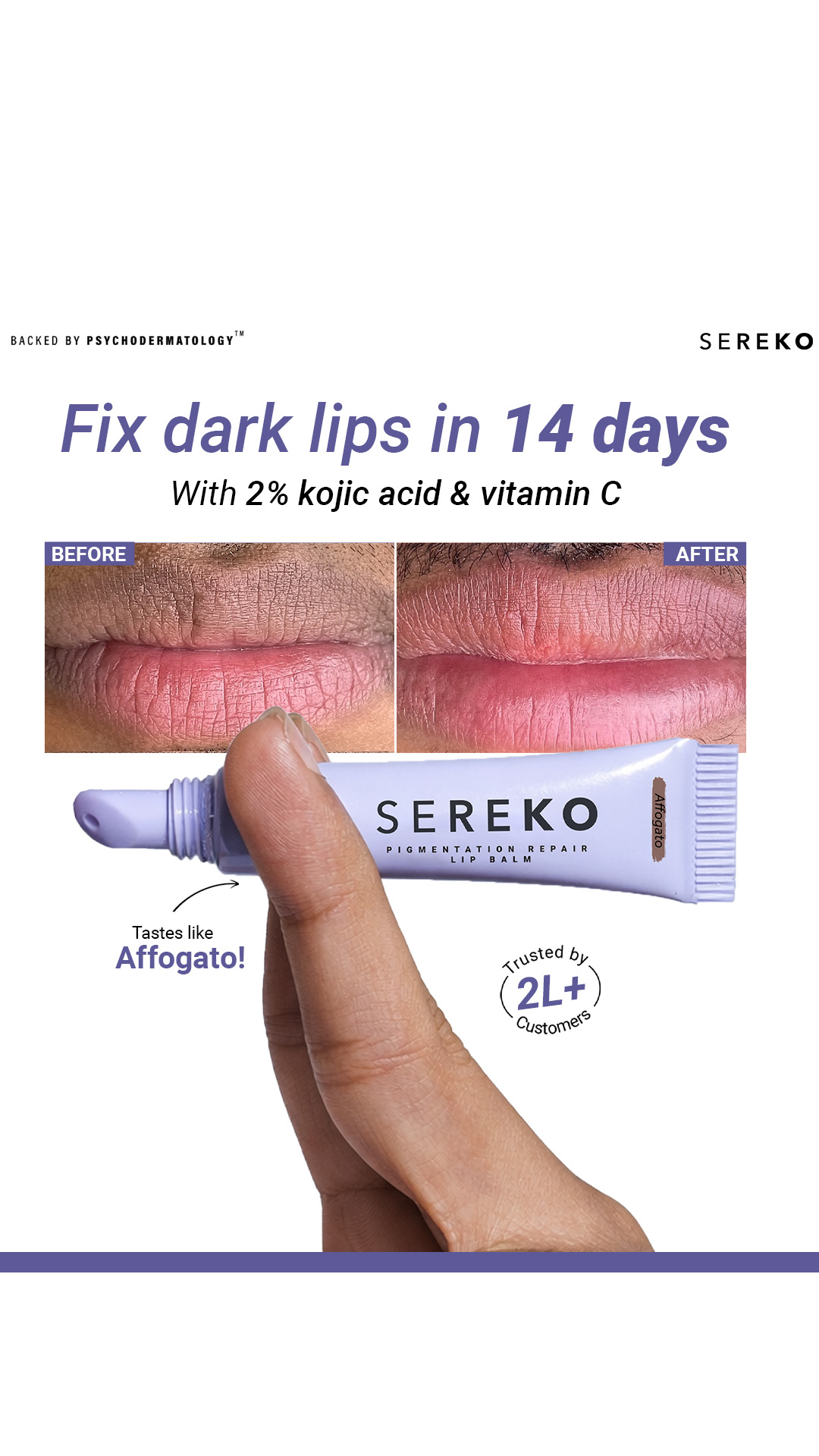 Sereko Facebook ad