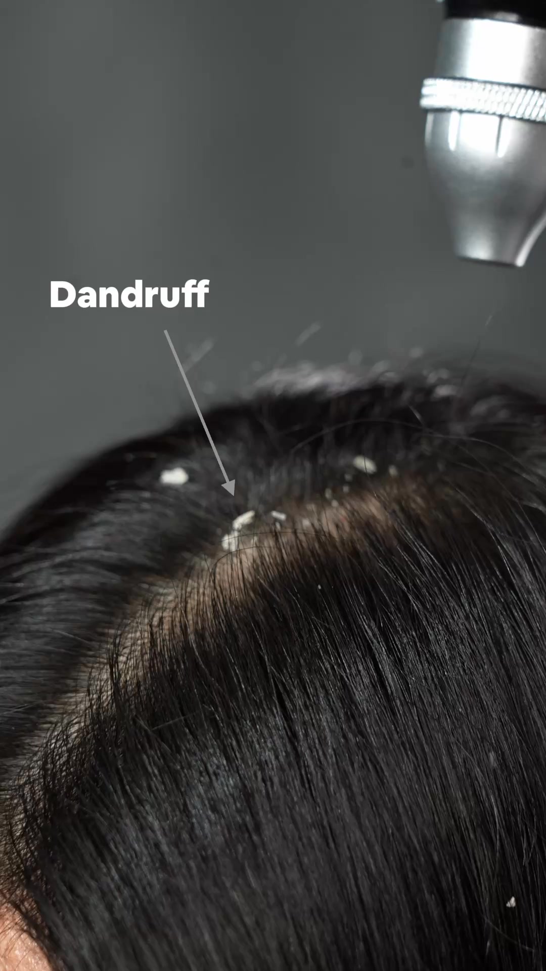 Hair Doc Facebook ad: Fresh Scalp, Better Mood