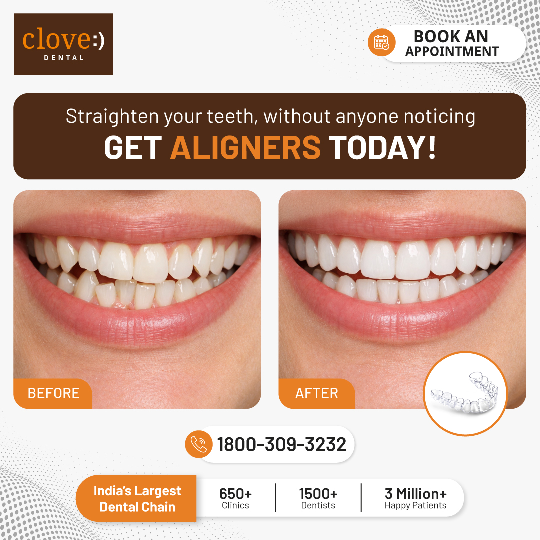 Clove Dental Facebook ad