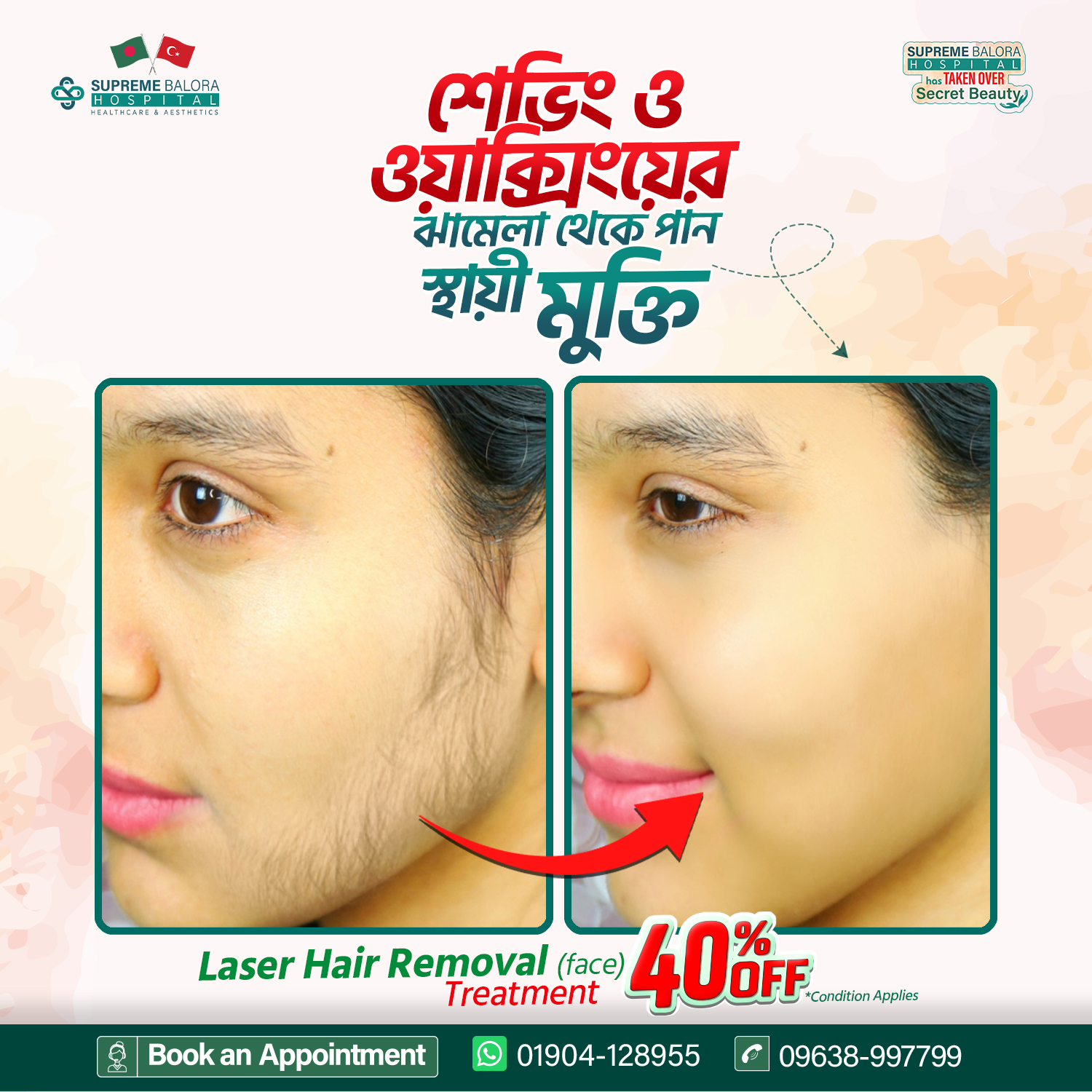 Supreme Balora Hospital Aesthetics Care Facebook ad: 𝐋𝐚𝐬𝐞𝐫 𝐇𝐚𝐢𝐫 𝐑𝐞𝐦𝐨𝐯𝐚𝐥 -অপ্রয়োজনীয় লোম আর…