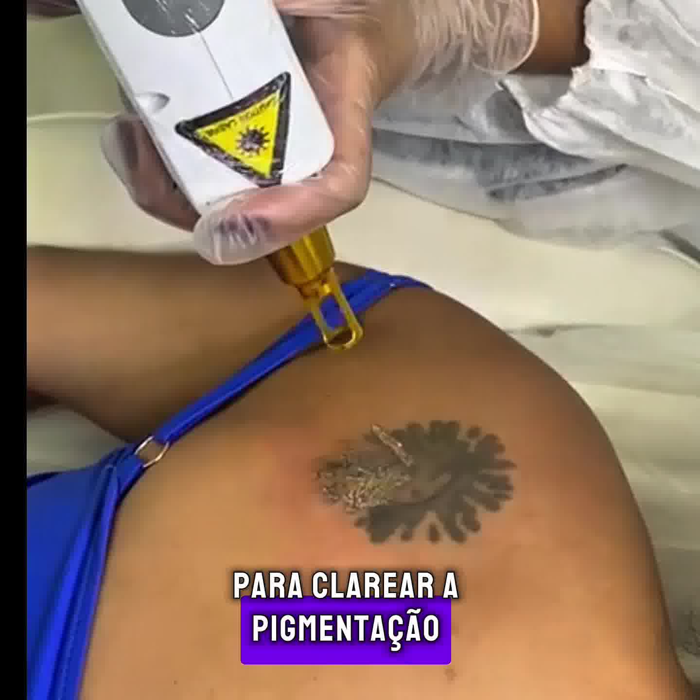 Adriana Hortmann Micropigmentação Capilar Facebook ad from Jul 2, 2026