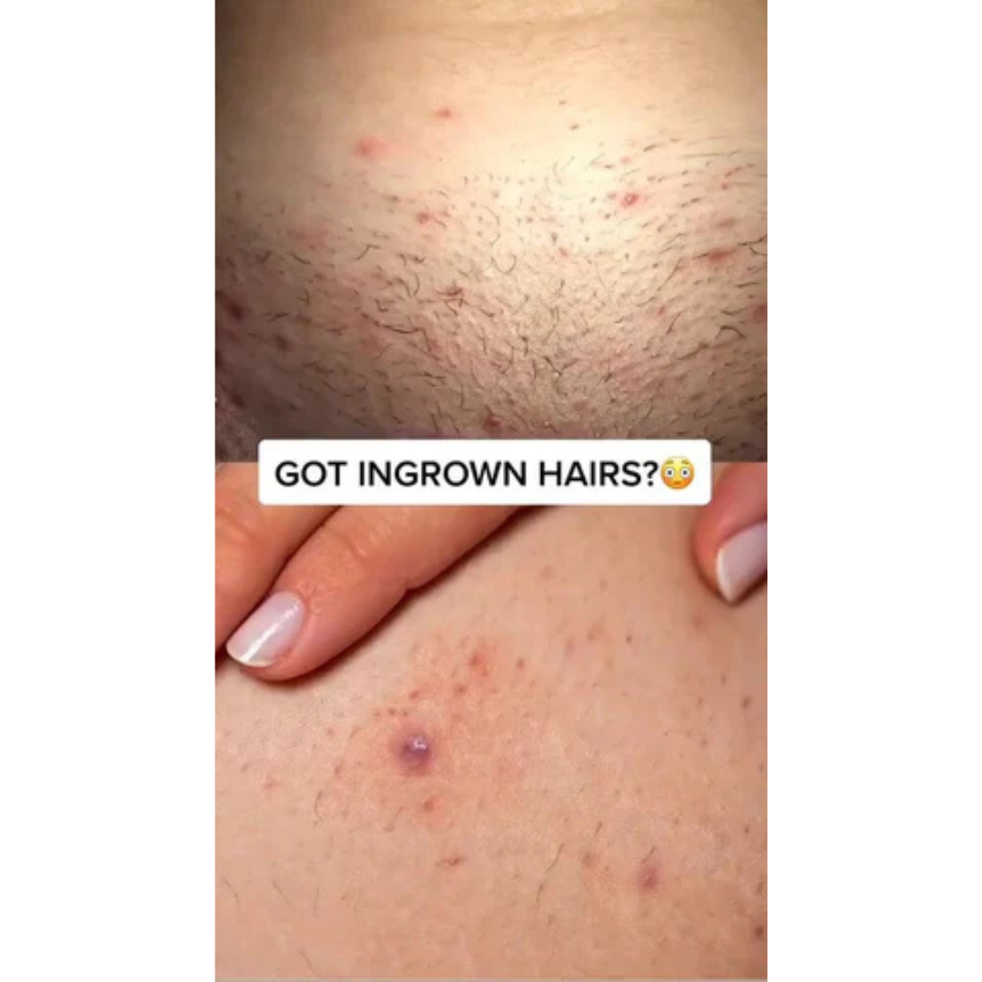 VitalBloom Facebook ad
