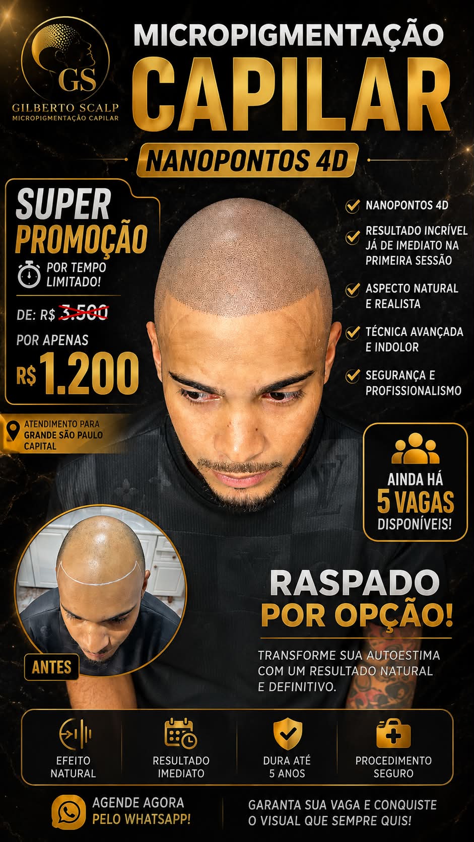 Gilberto ππππ₯π© Facebook ad: SUPER PROMOΓΓO POR TEMPO LIMITADO!