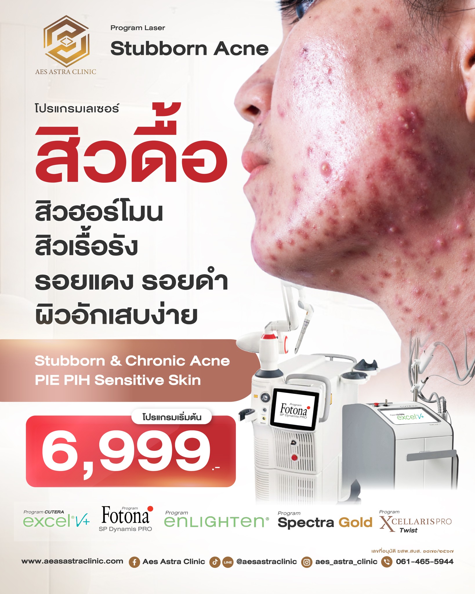 Aes Astra Clinic Facebook ad