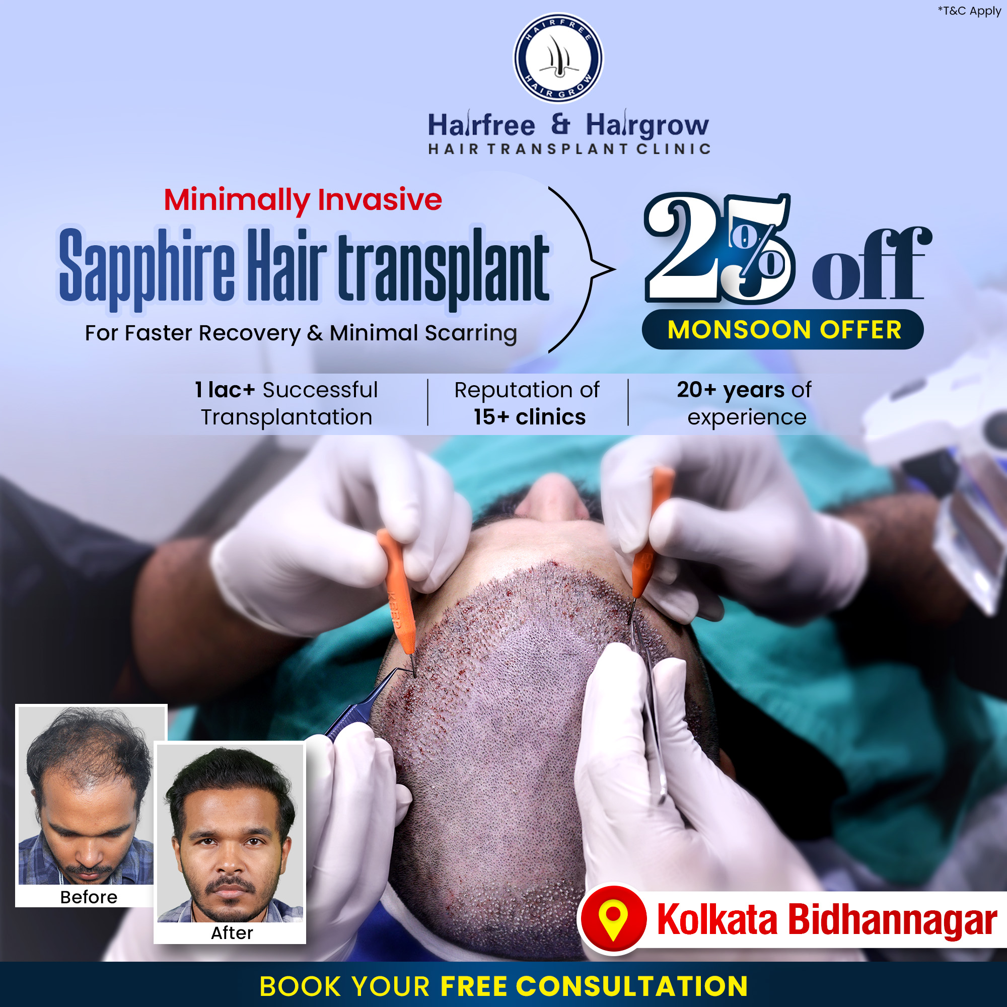 Hairfree Hairgrow Clinic Facebook ad