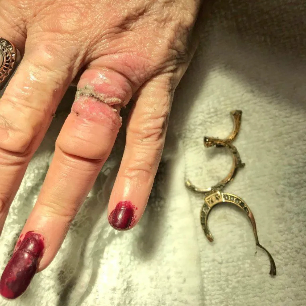 The Menopause Journal Facebook ad: Menopause did this to her hands