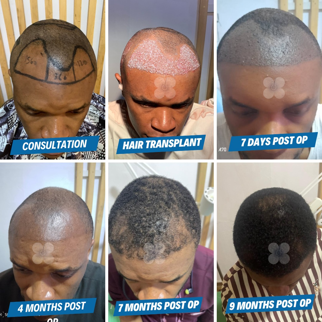 Hair Treatment Agency Rwanda Facebook ad