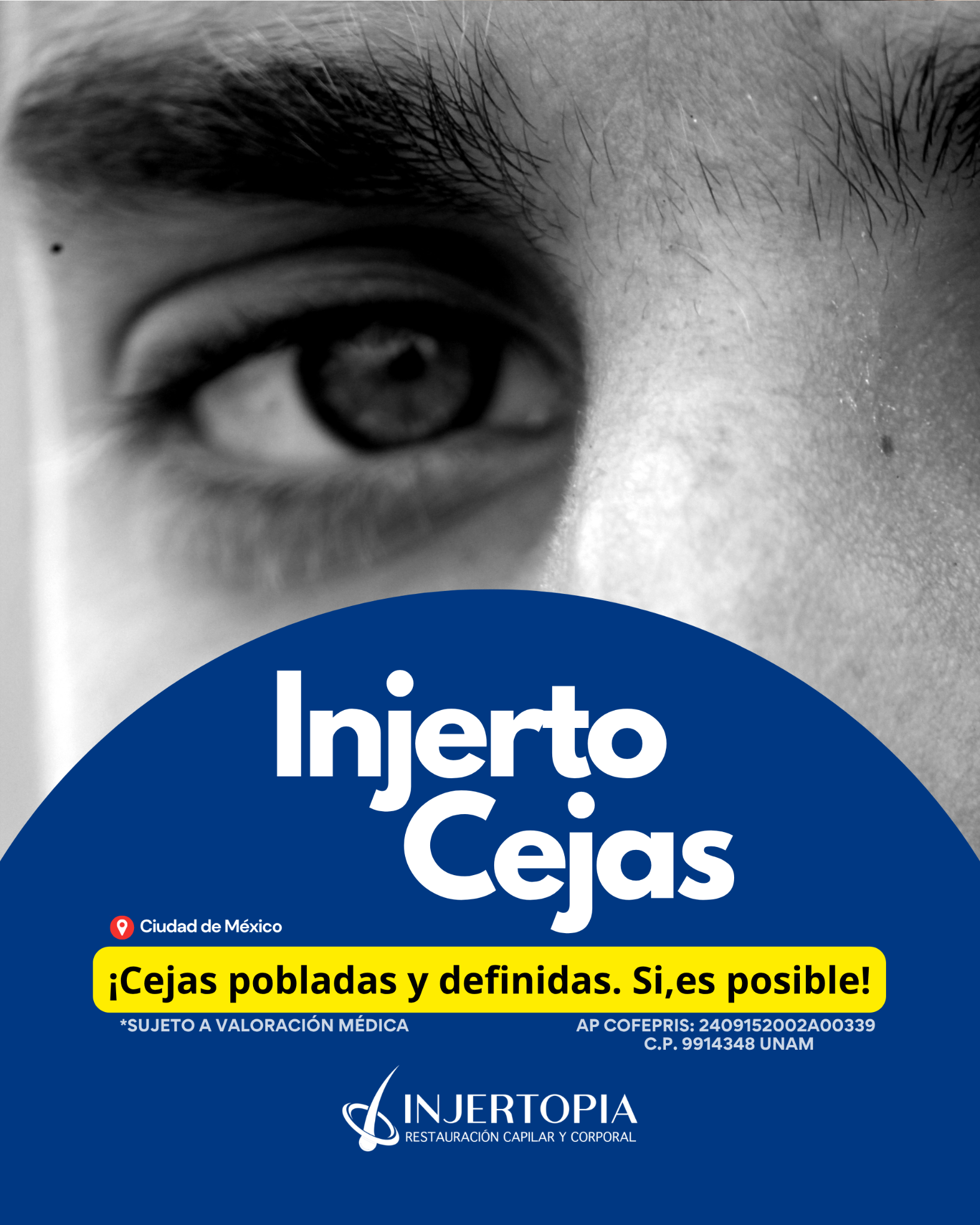 Injertopia - Restauración capilar y corporal Facebook ad