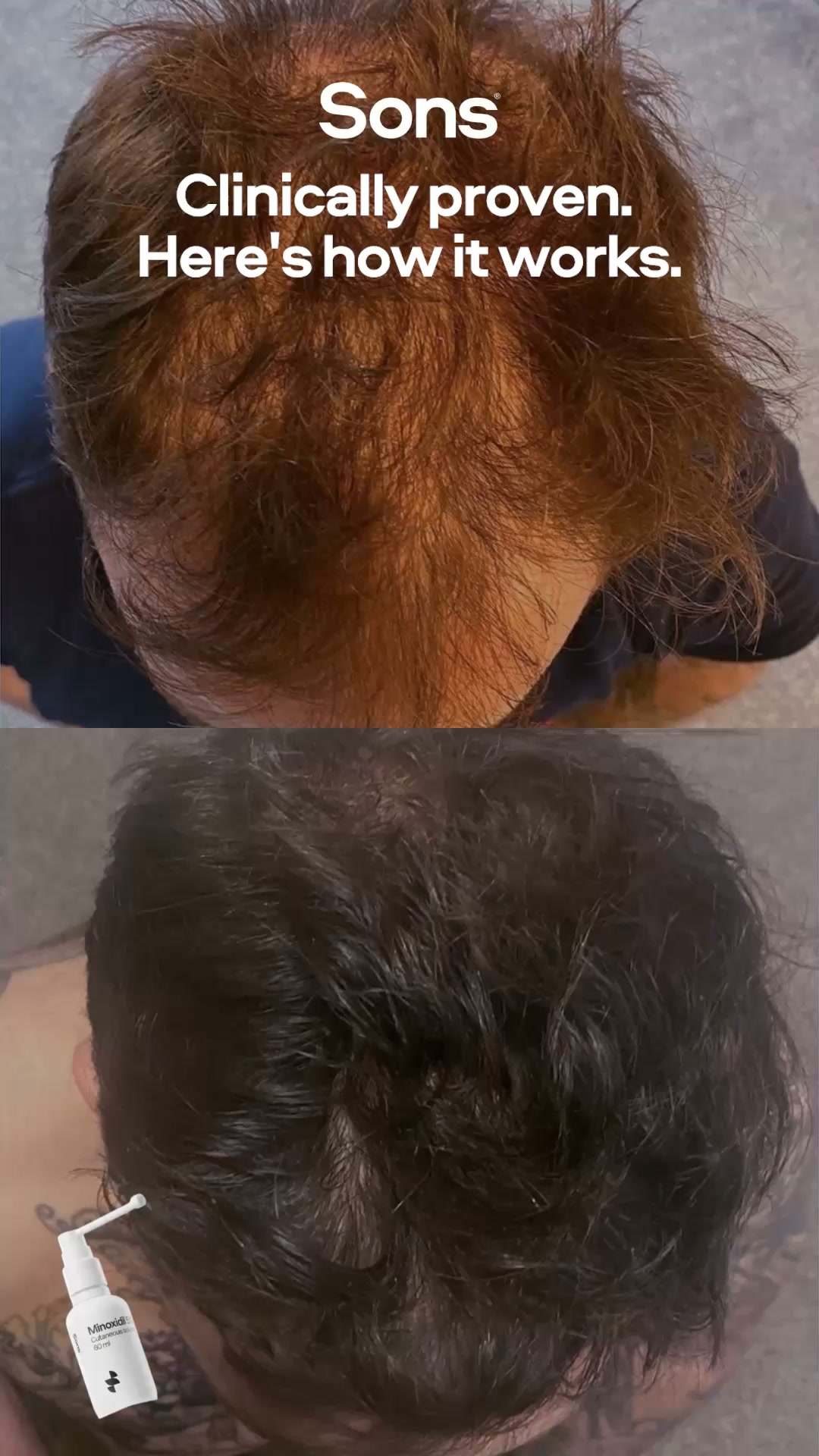 Sons Facebook ad: Your hairline. Your call.