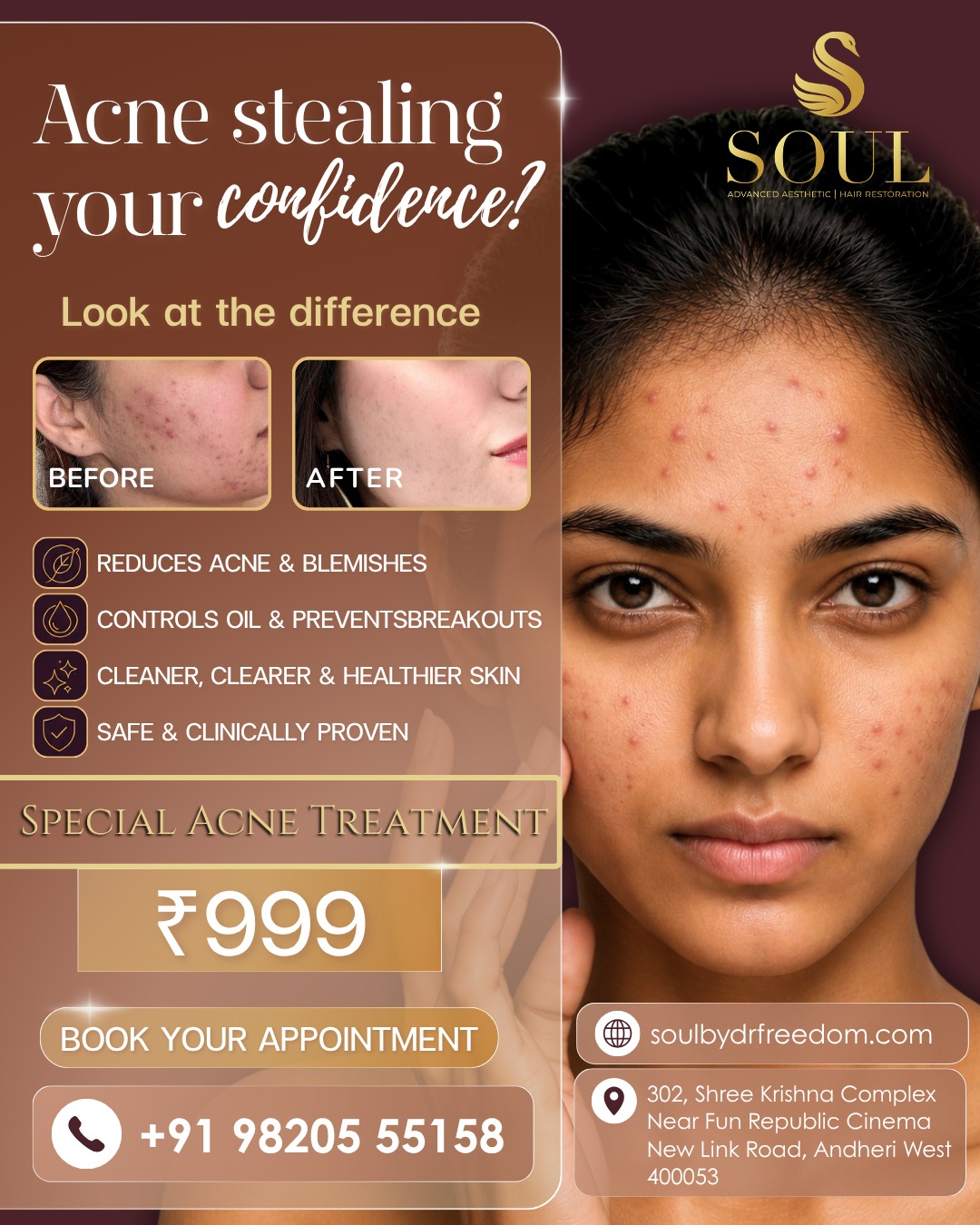 Soul Aesthetic Clinic Facebook ad: Advanced Acne Care @ ₹999