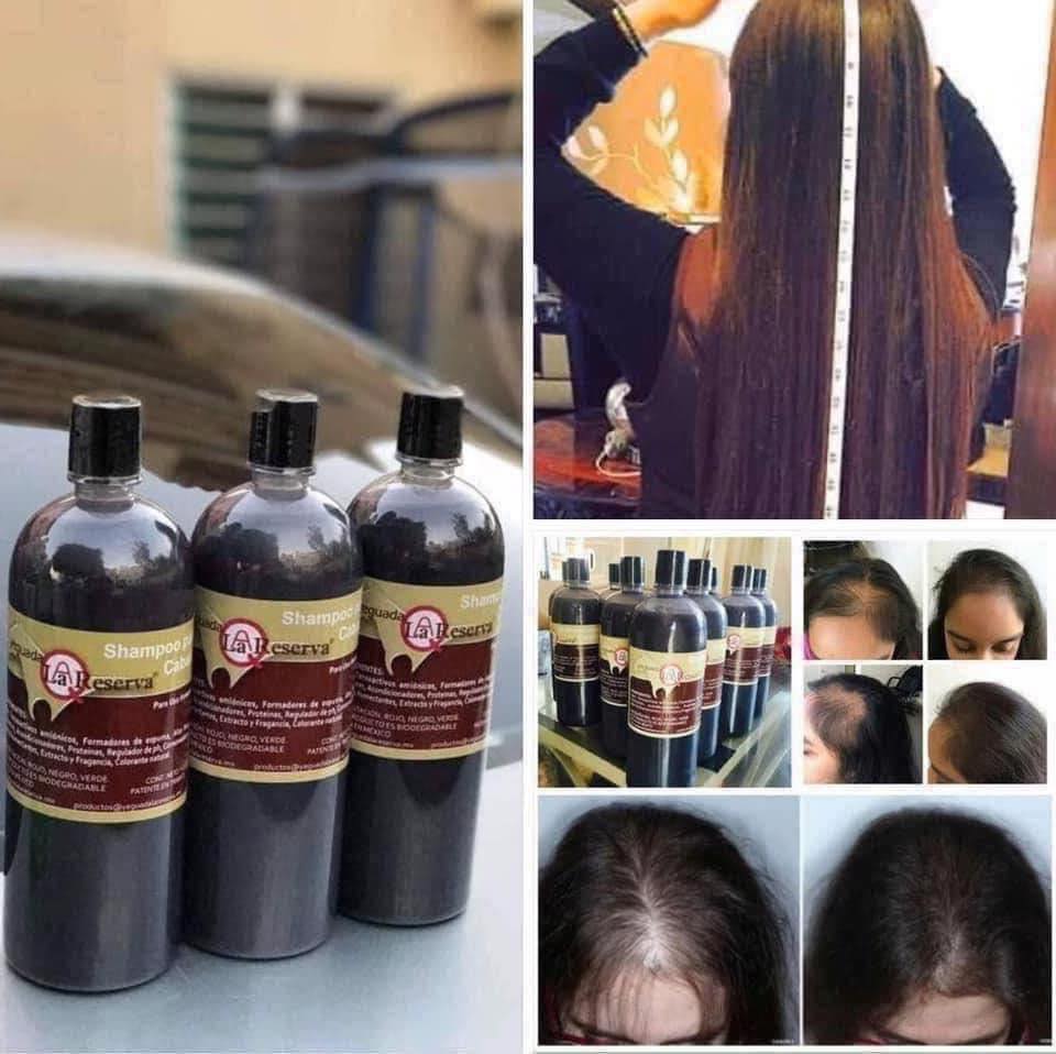 Colectivo Bahía Facebook ad: SE TE CAE EL CABELLO?