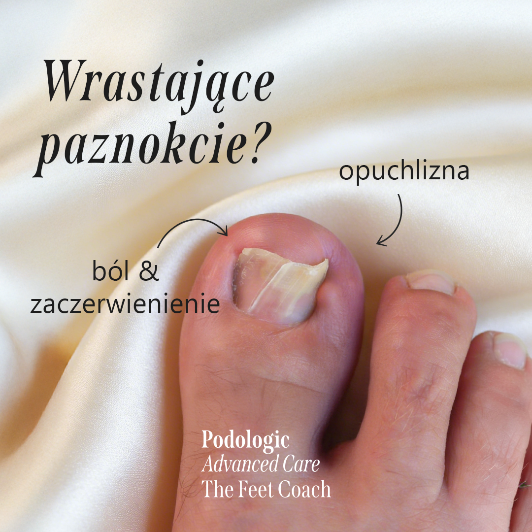 Podologic Expert Facebook ad