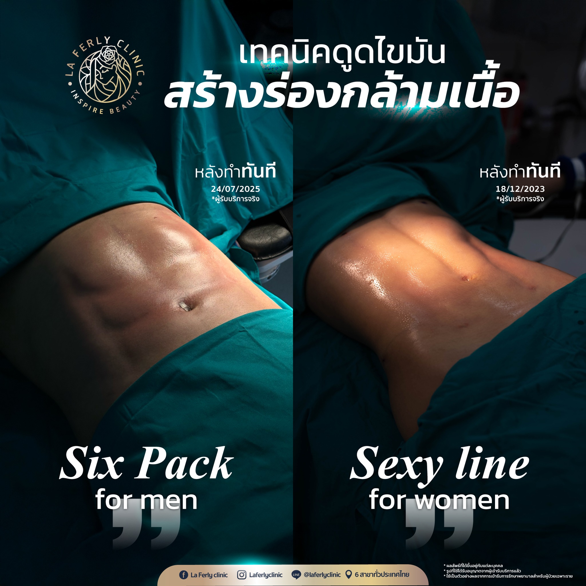 La Ferly clinic Facebook ad
