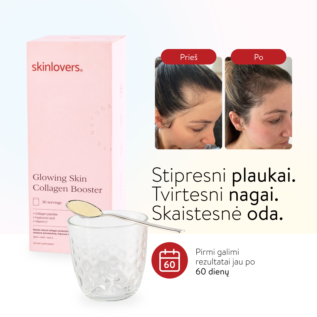Skinlovers Facebook ad