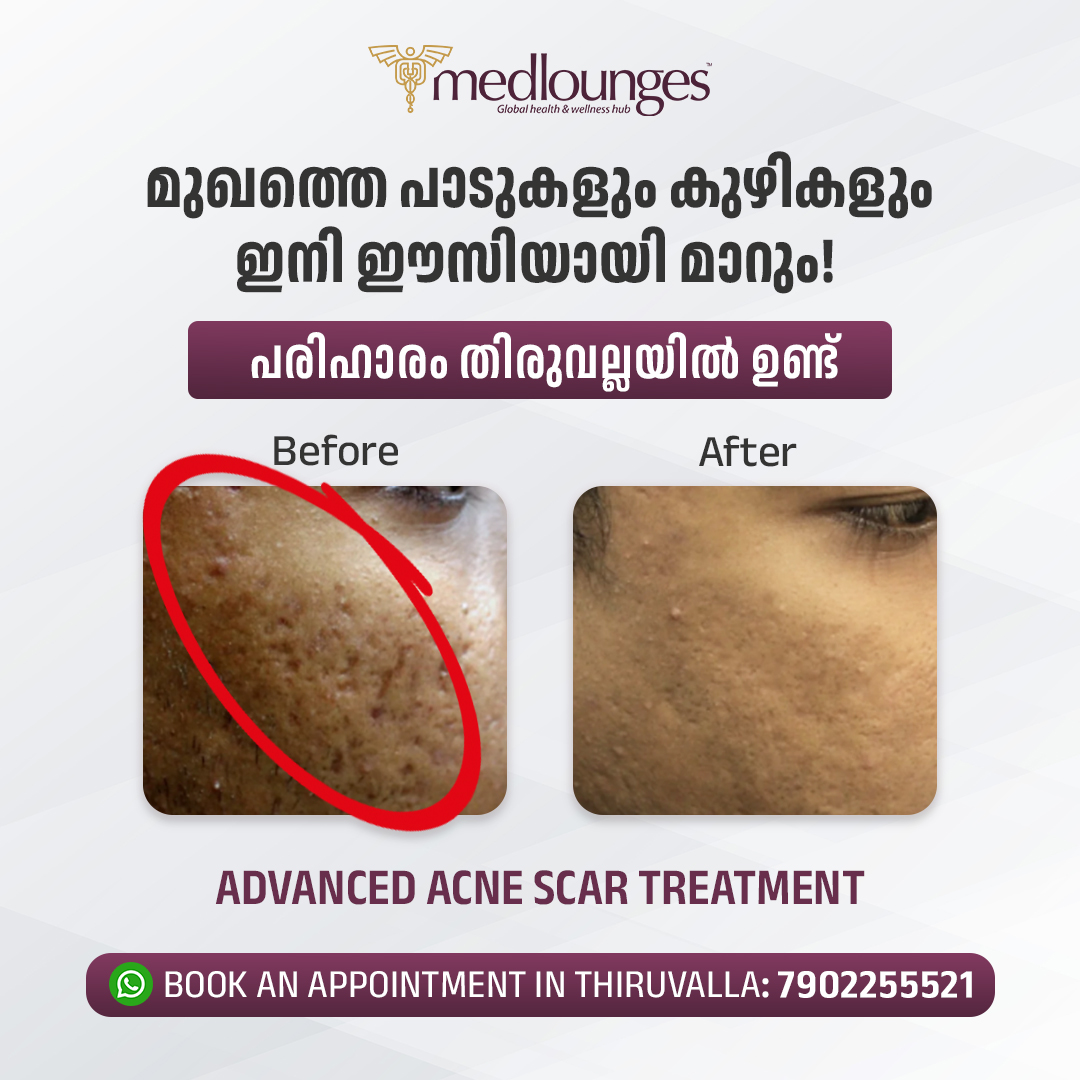 Medlounges Aesthetics Facebook ad