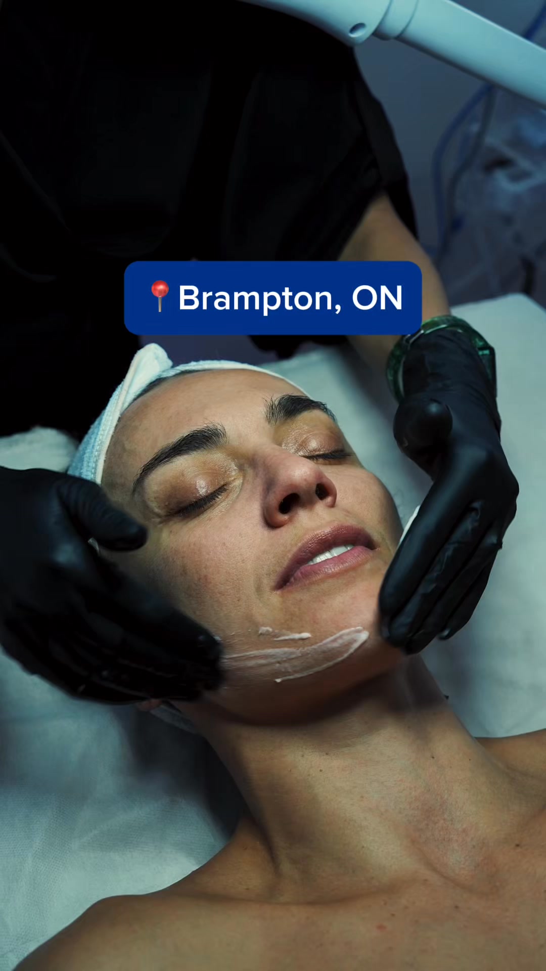 Skin Care Clinic Facebook ad: LIMITED SPOTS