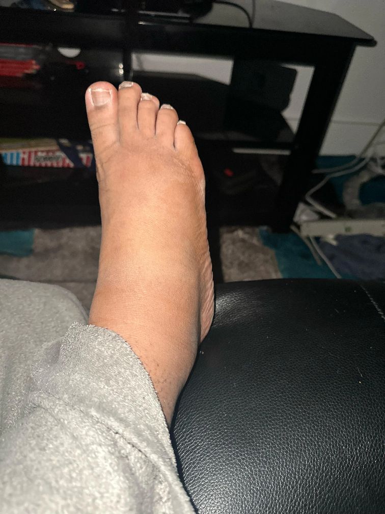 Tina Cooper Facebook ad: My feet were so swollen by evening I couldn’t get my shoes…