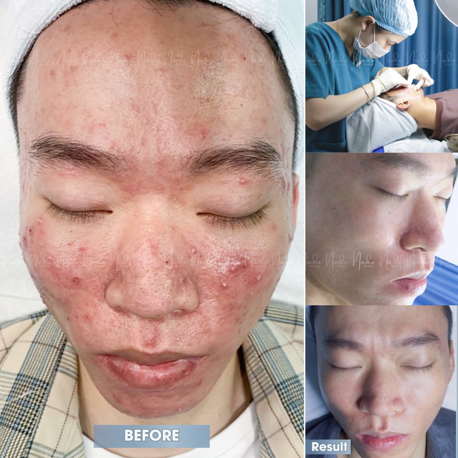 Nado Clinic Davao Facebook ad