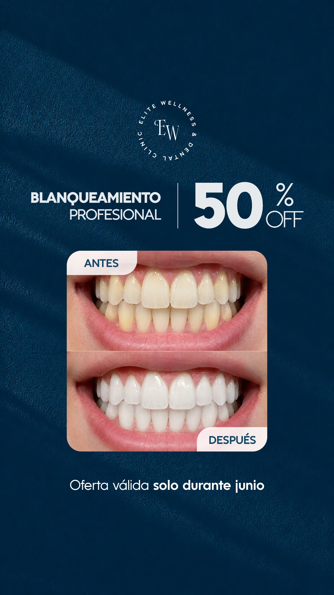 Elite Wellness and Dental Clinic Facebook ad