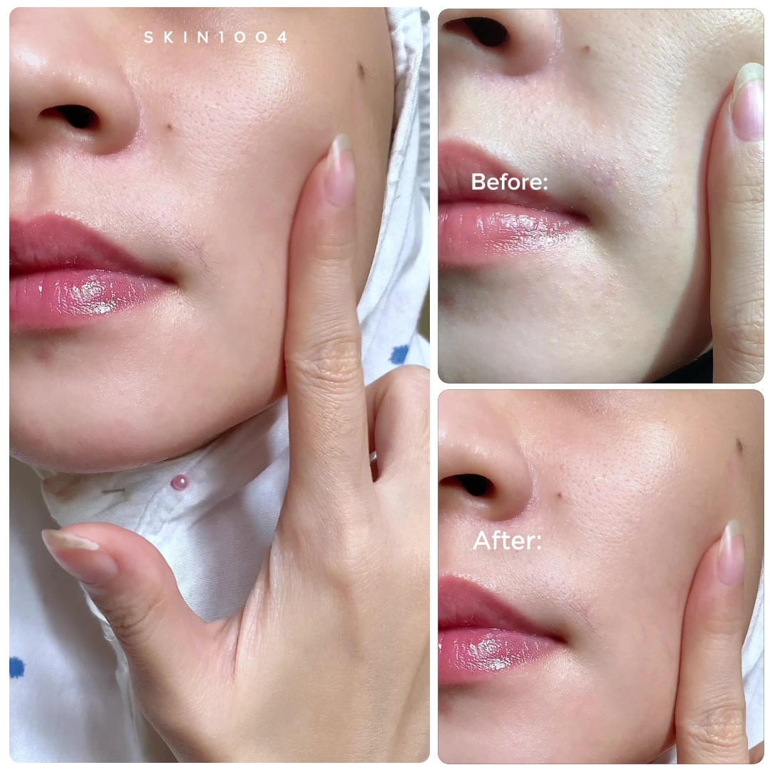 SKIN1004 Malaysia Facebook ad: BESTSELLER Madagascar Centella Ampoule