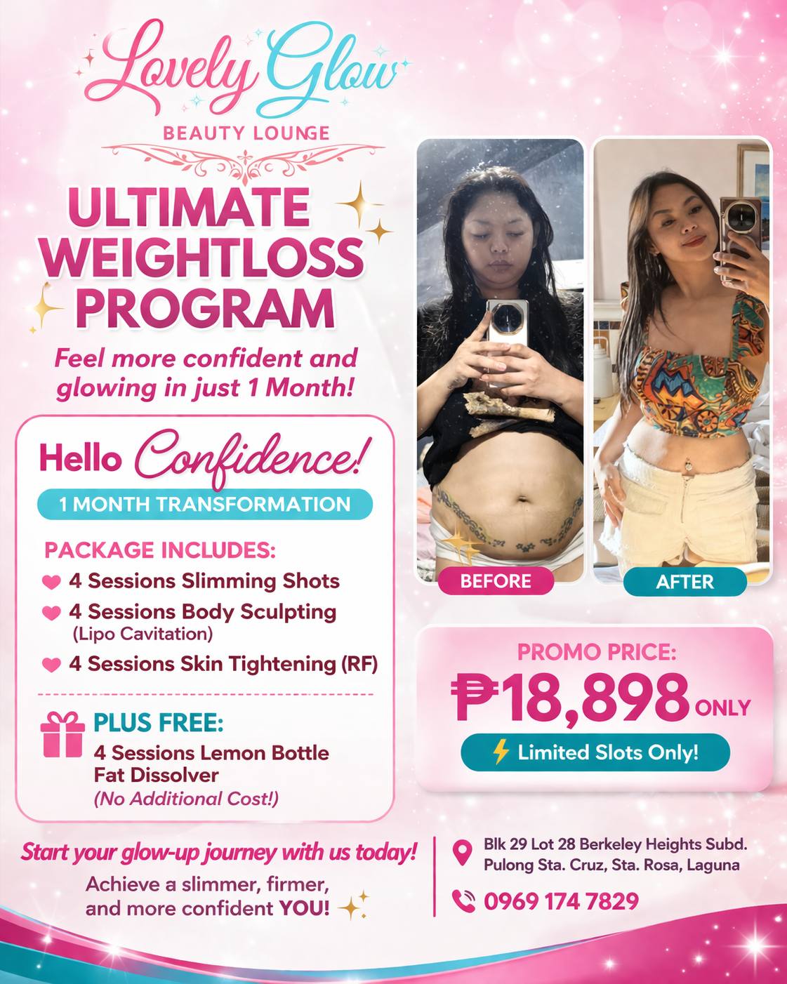 Lovely Glow- Sta. Rosa Laguna Facebook ad