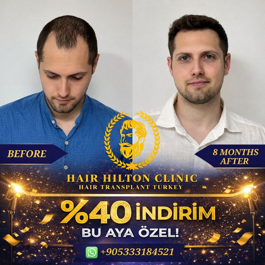 SAÇ EKİMİ istanbul Facebook ad: Chat with us
