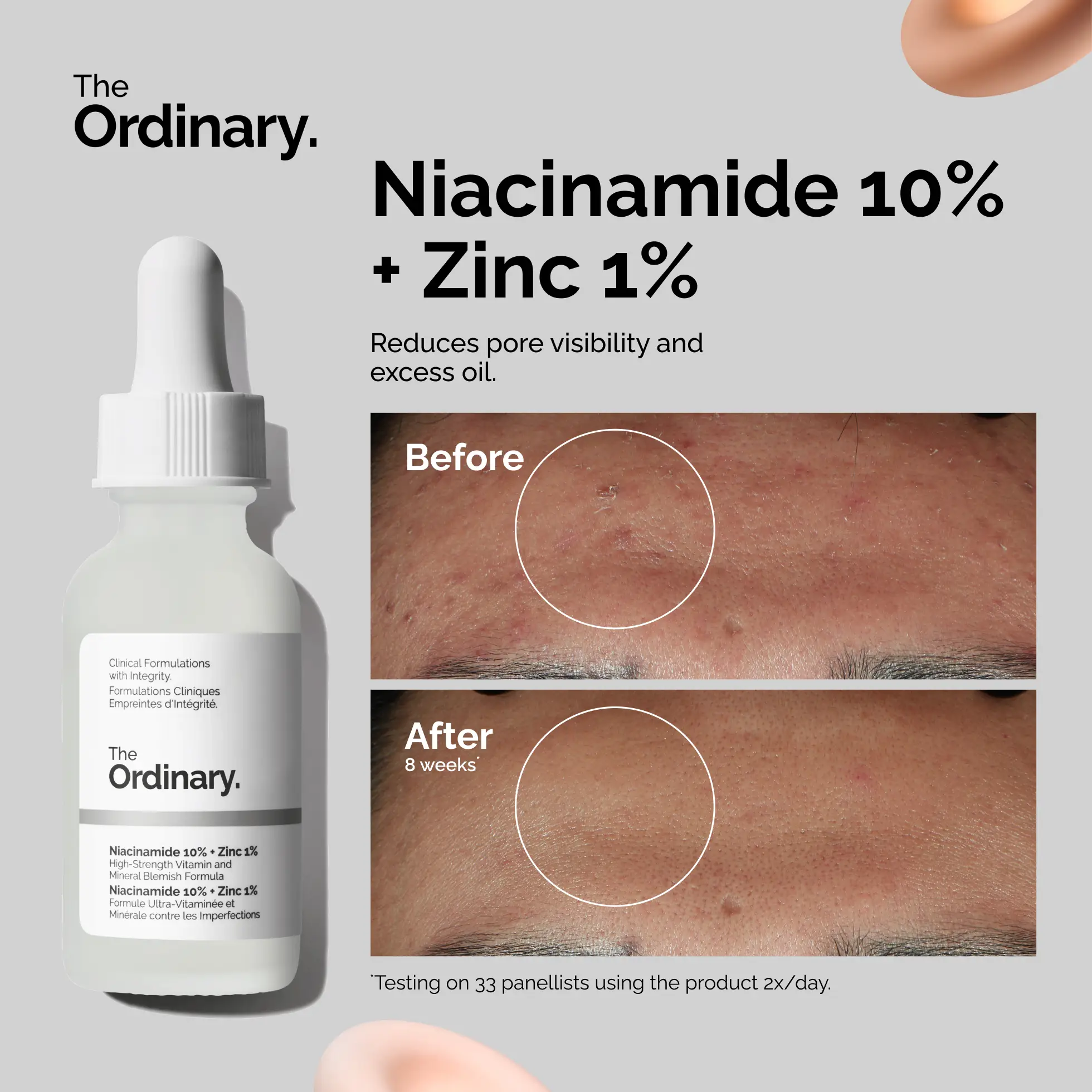 The Ordinary Facebook ad