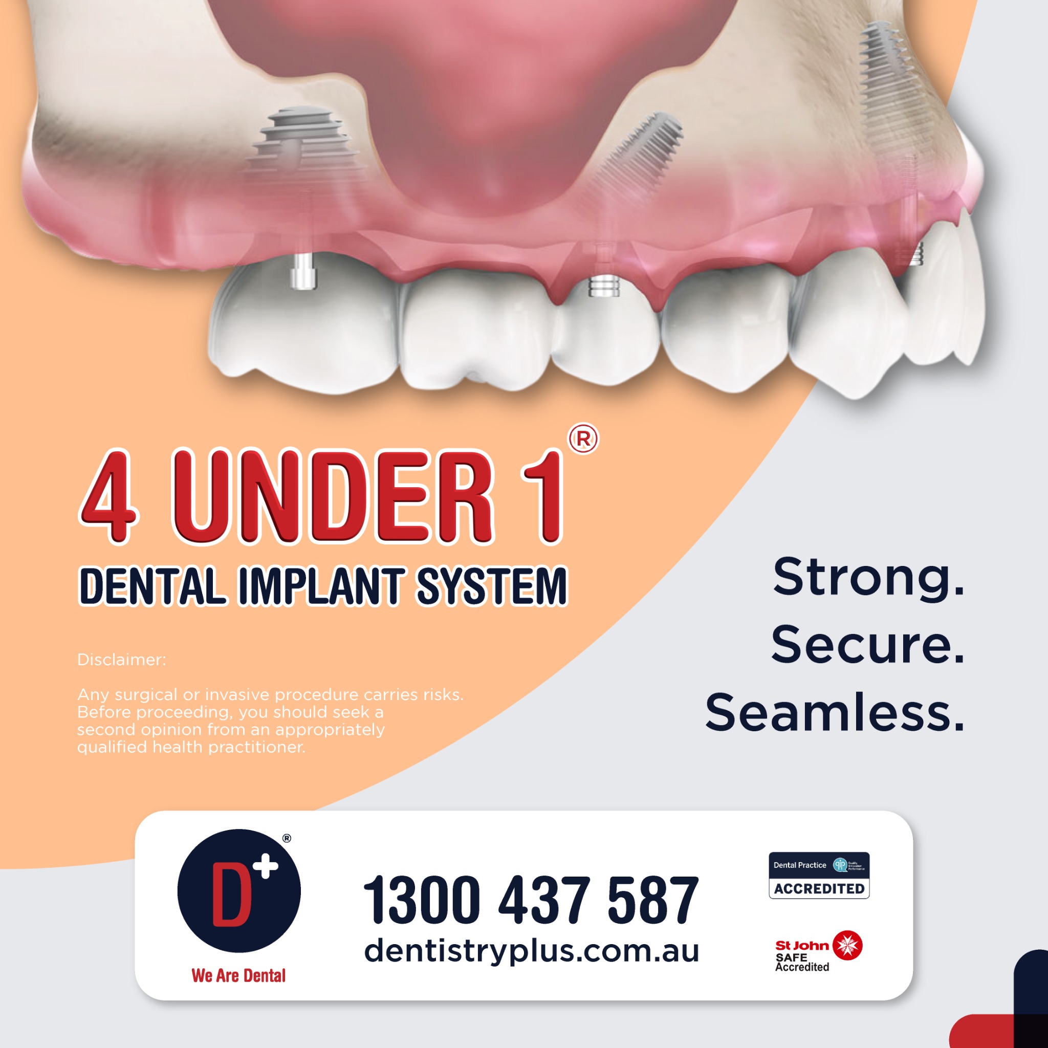 Dentistry Plus Facebook ad: Ready for a Permanent Smile Transformation?