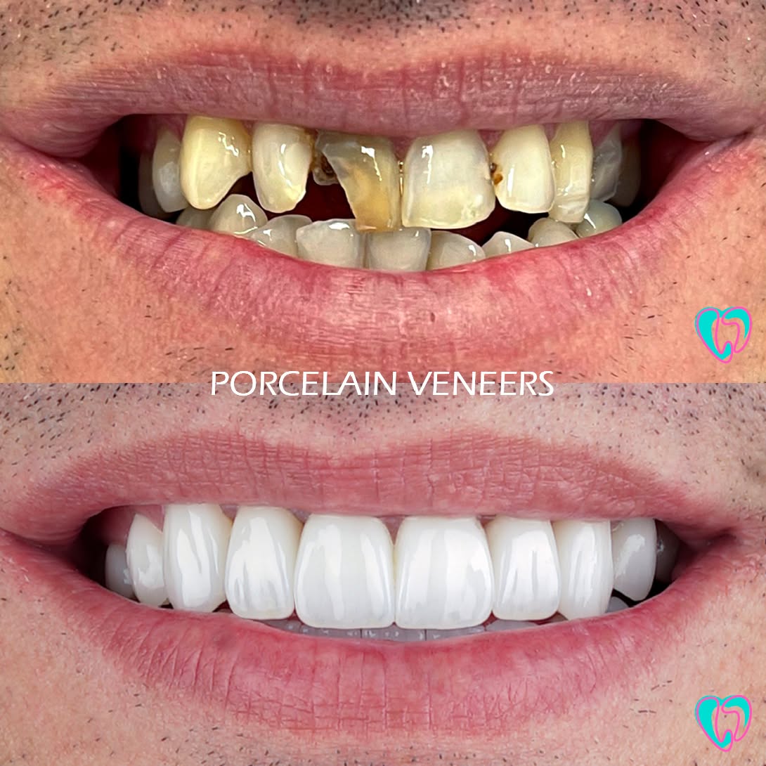 Smile Design Mia Facebook ad
