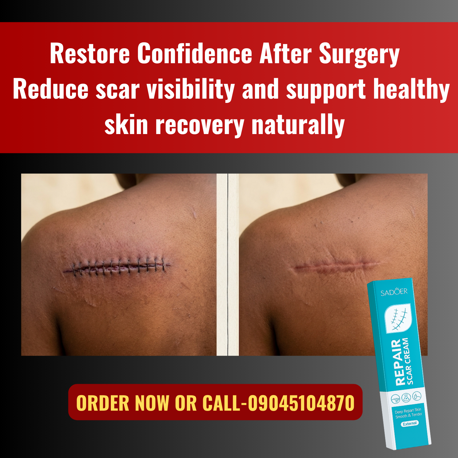 Scar Repair Clinic Facebook ad