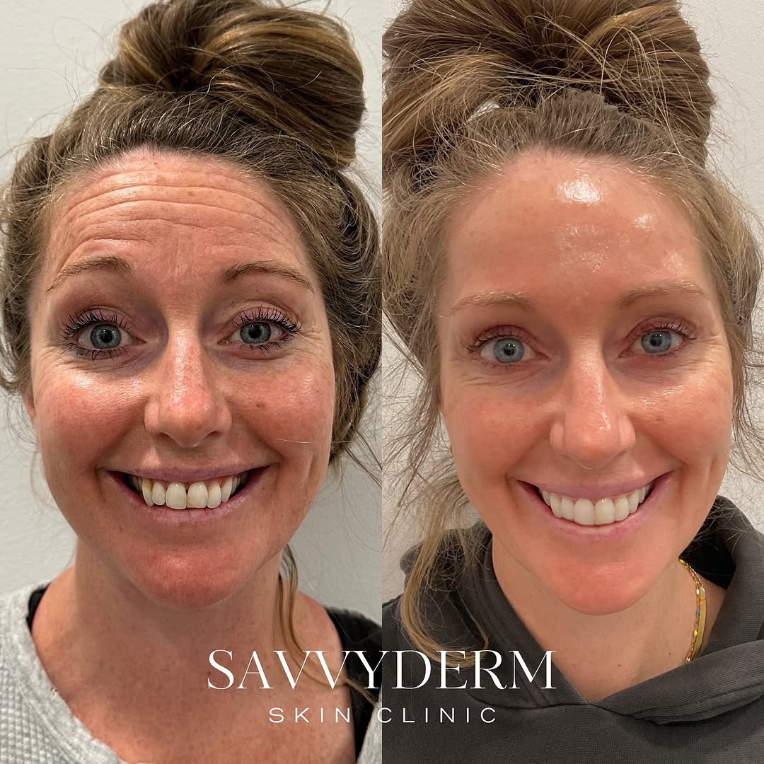 SavvyDerm Facebook ad: Get $75 towards your personalized skincare regimen when…